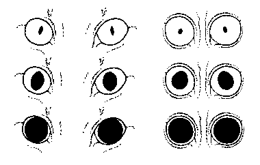 What is normal pupil size?